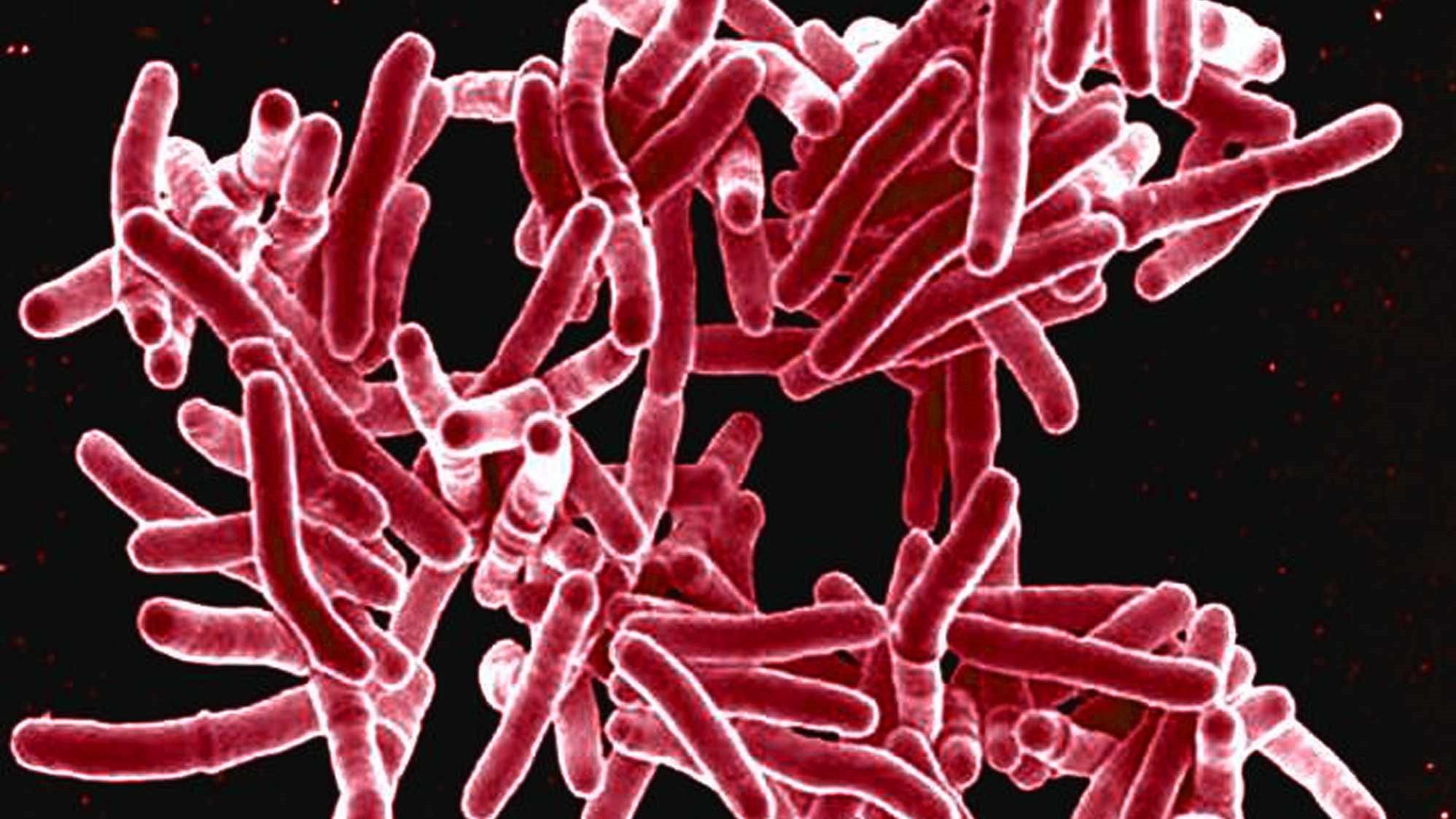 Уничтожаем бактерии туберкулеза с помощью ферментов — Teletype